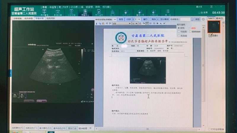 成都慢病管理中心如何选择，看这4个关键点**